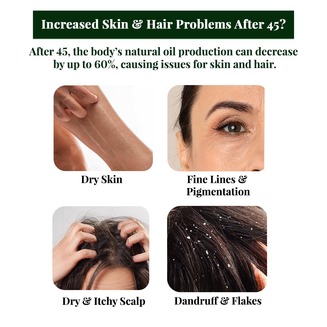 Aloe Vera Gel - 500g | 100% Pure Aloe Vera Enriched With Ashwagandha & Tea Tree Oil |For Face, Skin & Hair