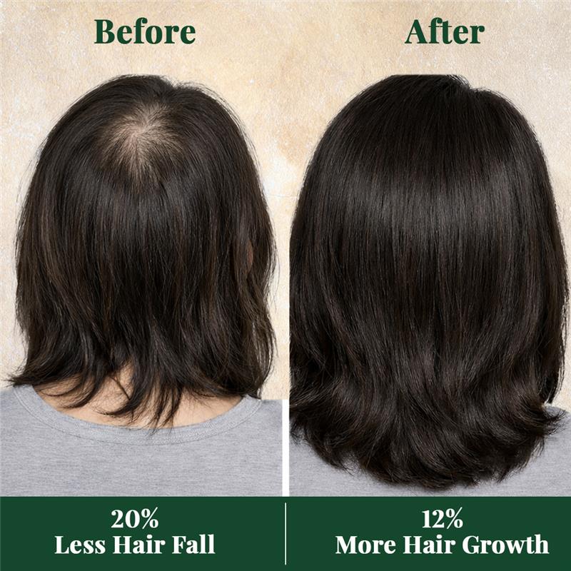 Clinically Proven Hair Oil For 45+ | Reduces Hair Fall | With 4X Bhringhraj | 19 Potent Herbs