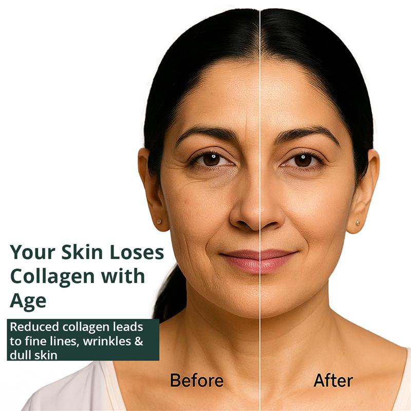 Liquid Collagen with 16 Proven Herbs like Sea Buckthorn & Vitamin C for 98% Brighter Skin