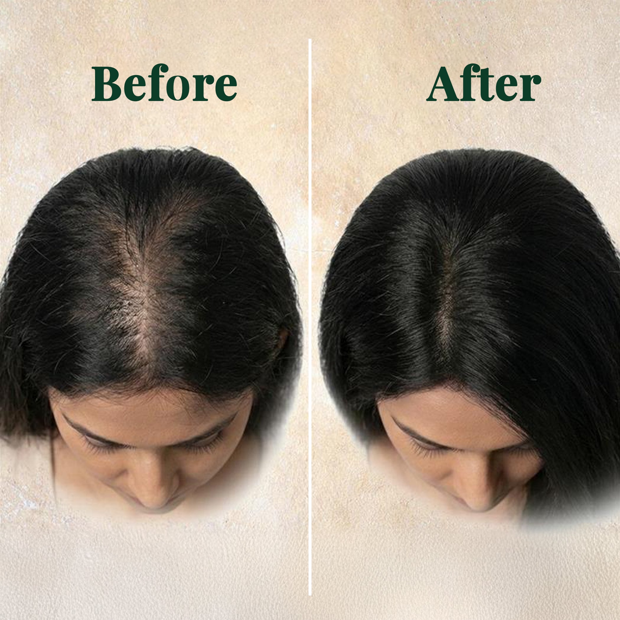 Clinically Proven Hair Oil For 40+ Women | Reduces Hair Fall | With 4X Bhringhraj | 19 Potent Herbs